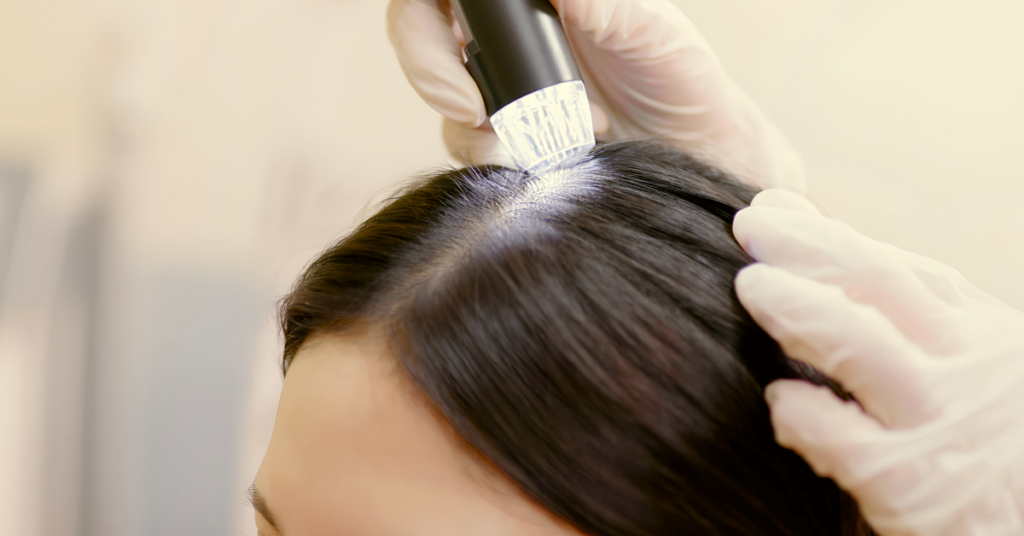 Advantages of Stem Cell Hair Restoration
