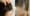 Stem Cell Hair Restoration vs. Hair Transplants: A Comprehensive Guide for Women